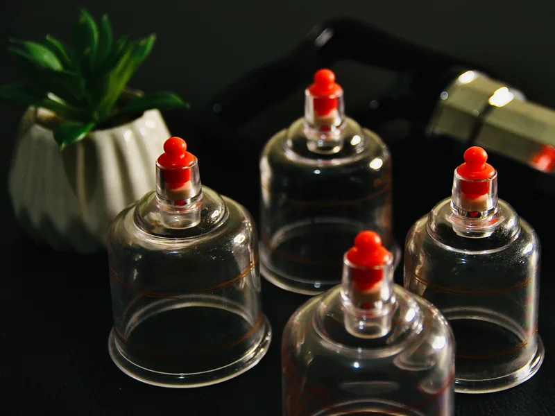 How Cupping Therapy works at Carroll Chiropractic