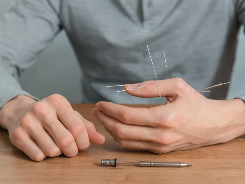 Dry Needling at Carroll Chiropractic in Westminster