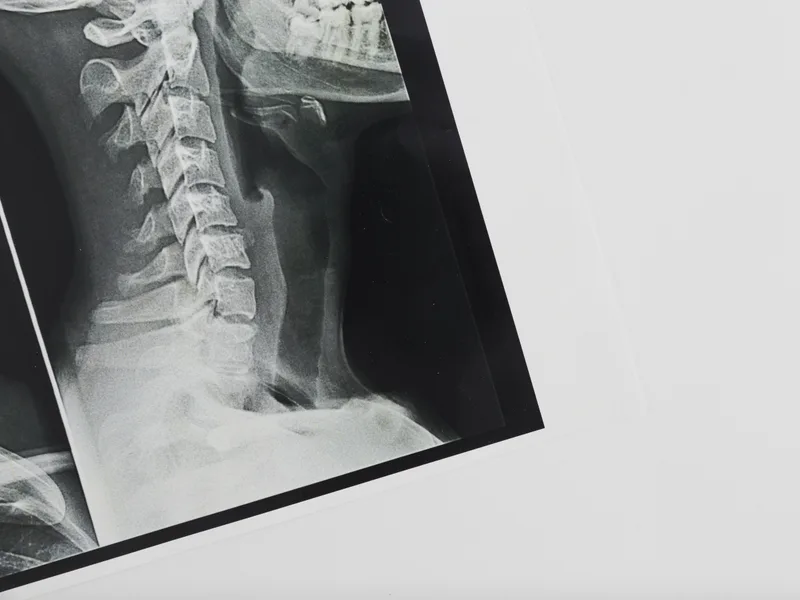X-Rays at Carroll Chiropractic in Westminster