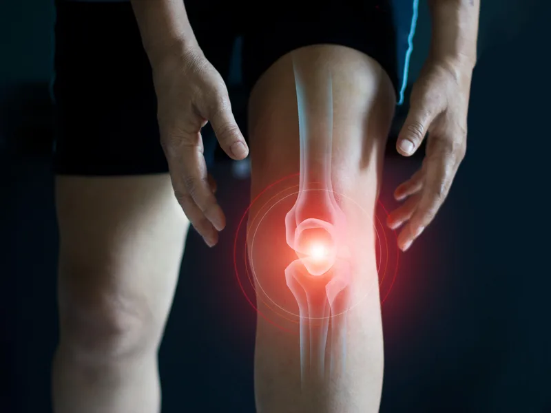 How Carroll Chiropractic treats arthritis in Westminster